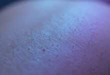 Close-up macro shot of human skin with goosebumps, showing the hairs standing on end, with a soft, ethereal blue and purple light.